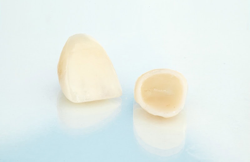 ceramic dental crowns